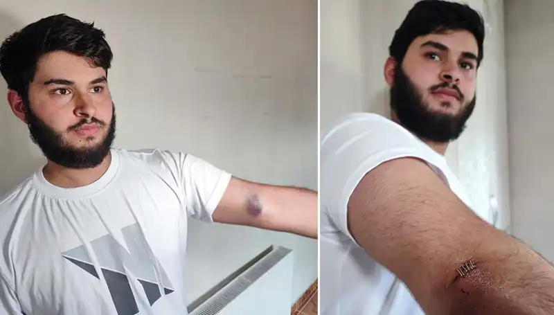Bahçeye Kaçan Top, Mahallede Gözler Önünde Olay Yarattı!